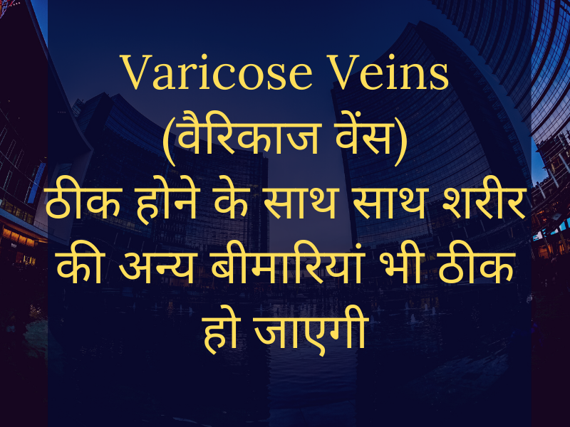 Cure Varicose Veins (पैर की फूली हुई नस से संबंधित) as well as cure other health problems